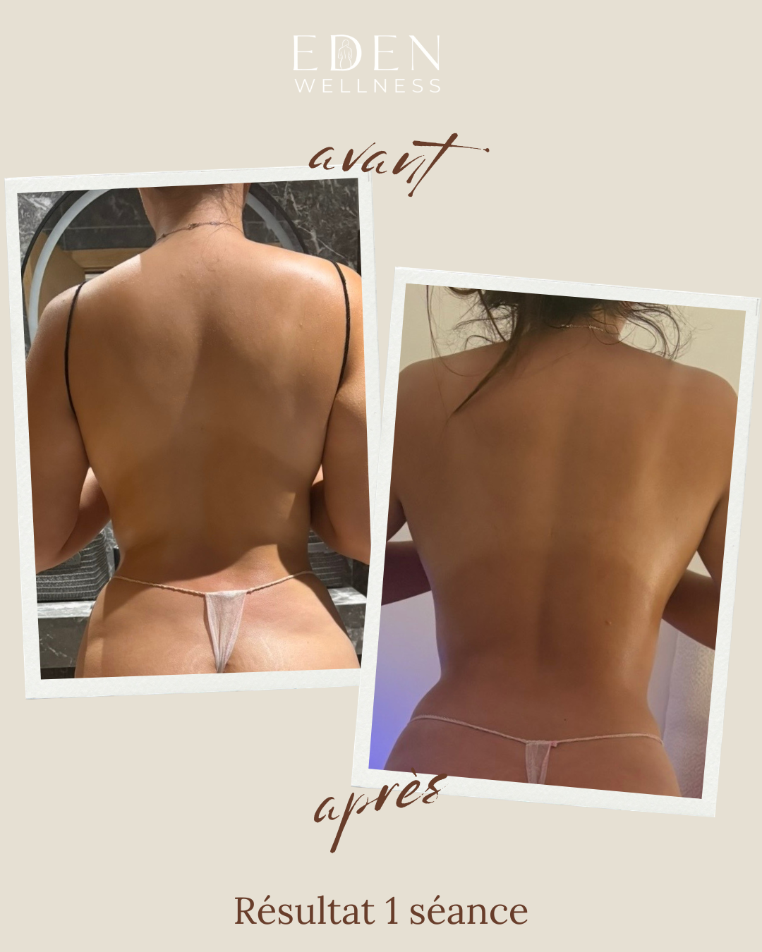 Avant après modelage dos — résultat 1 séance Eden Wellness